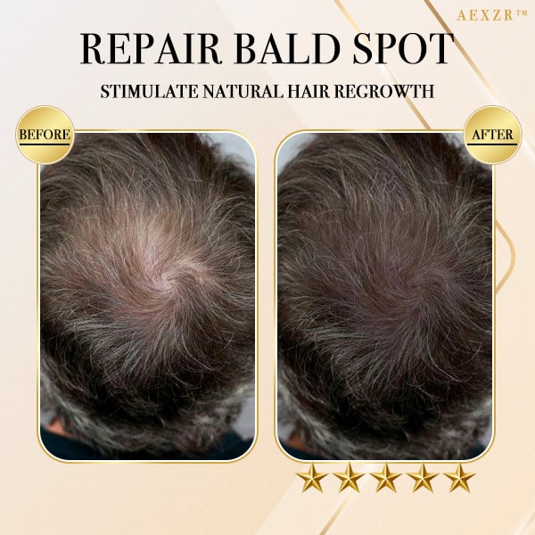 Aexzr™ Ginger Hair Regrowth Shampoo Bar