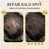 Aexzr™ Ginger Hair Regrowth Shampoo Bar
