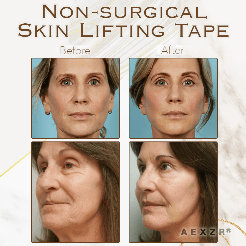 Cithway® Pro-Beauty Instant Facial Skin Lifting Tape